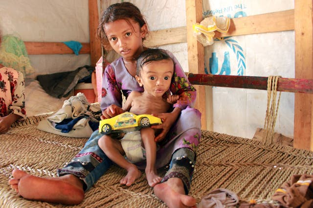 Displaced Yemeni children in desperate need of medical treatment and food