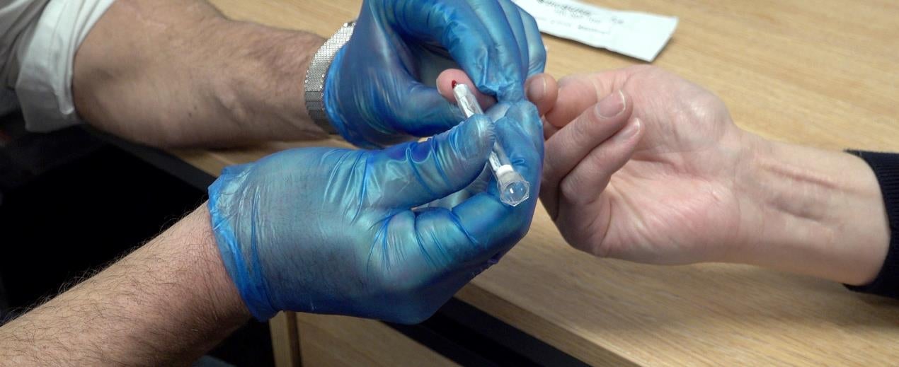 A rapid HIV test being used in the UK