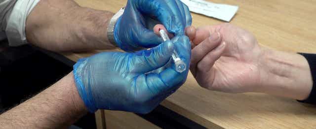 <p>A rapid HIV test being used in the UK</p>