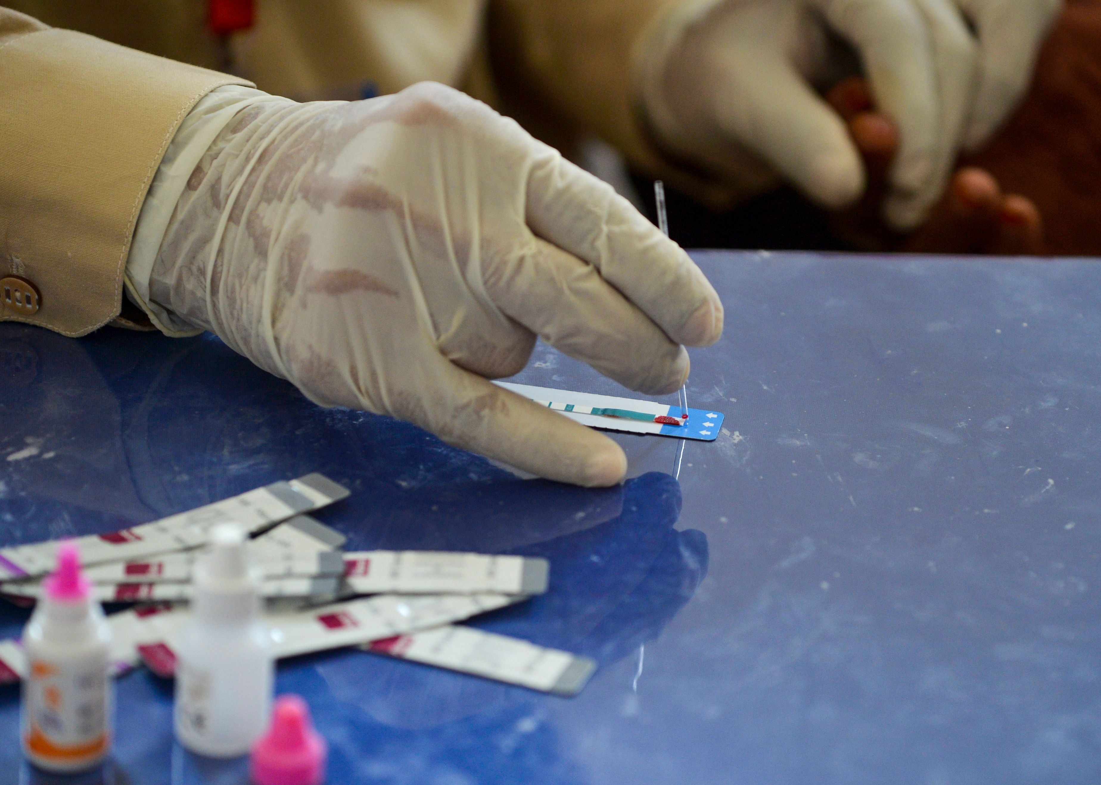 A doctor examines a blood sample taken from a woman during an HIV test