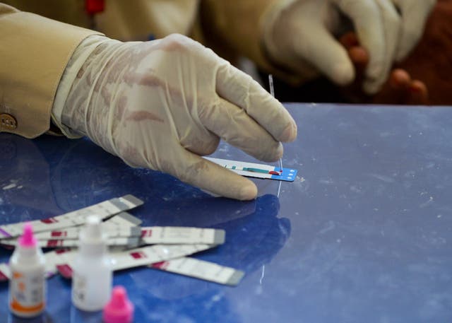 <p>A doctor examines a blood sample taken from a woman during an HIV test</p>