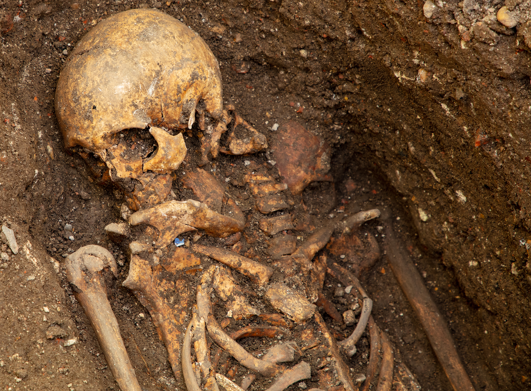 Many skeletons show the bodies were dissected before burial