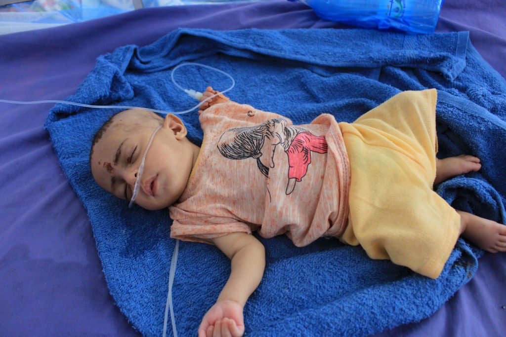 A child receives treatment at a malnourishment centre in Yemen's northern Hajjah province