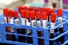 GPs ordered to halt all non-urgent blood tests across England until September