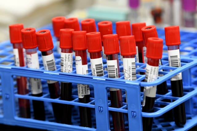<p>All blood testing in the community and by GPs has been stopped except for urgent cases </p>