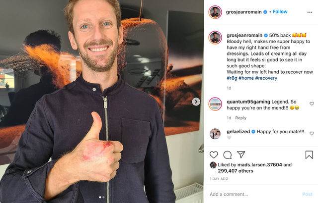 Romain Grosjean revealed the burns suffered to his right hand after having his dressing bandages removed