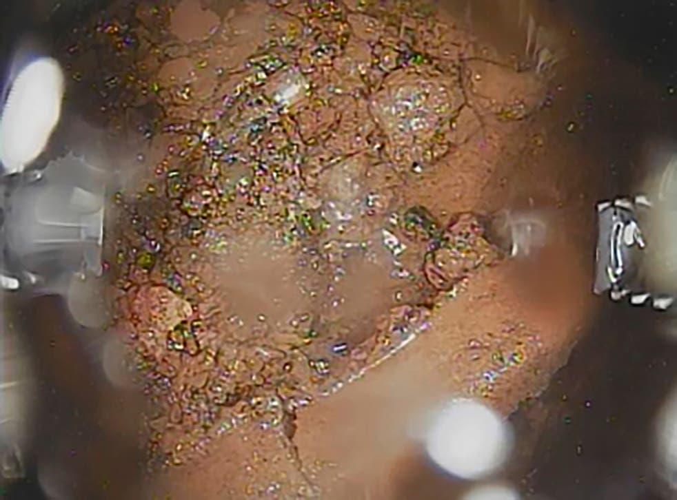 <p>Foto tomada el 2 de diciembre del 2019 por un robot telescópico del combustible chamuscado en la planta nuclear Fukushima de Japón. </p>