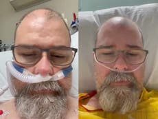 Former anti-masker says he was wrong in video filmed from hospital bed