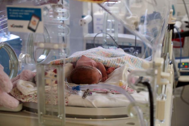 Un bebé recién nacido en la sala de maternidad del Frimley Park Hospital en Surrey el 22 de mayo de 2020 en Frimley, Reino Unido. Una madre advierte sobre la piel moteada y la enfermedad como posibles síntomas del coronavirus en los bebés después de que su bebé contrajo el virus.