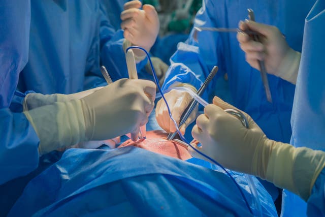 <p>Organ transplant surgery across the NHS </p>