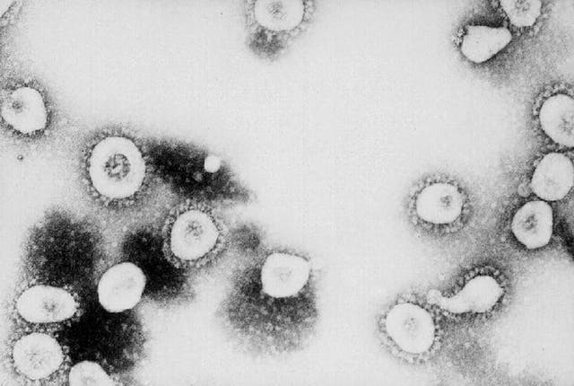 <p>ATLANTA, GA - SIN FECHA: Esta foto del folleto sin fecha de los Centros para el Control y la Prevención de Enfermedades (CDC) muestra una vista microscópica del Coronavirus en el CDC en Atlanta, Georgia. Según los CDC, el virus que causa el síndrome respiratorio agudo severo (SARS) podría ser un "virus de la familia del coronavirus no reconocido anteriormente".&nbsp;</p>