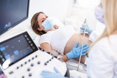 Pandemic is leading to baby bust, not baby boom, experts suggest