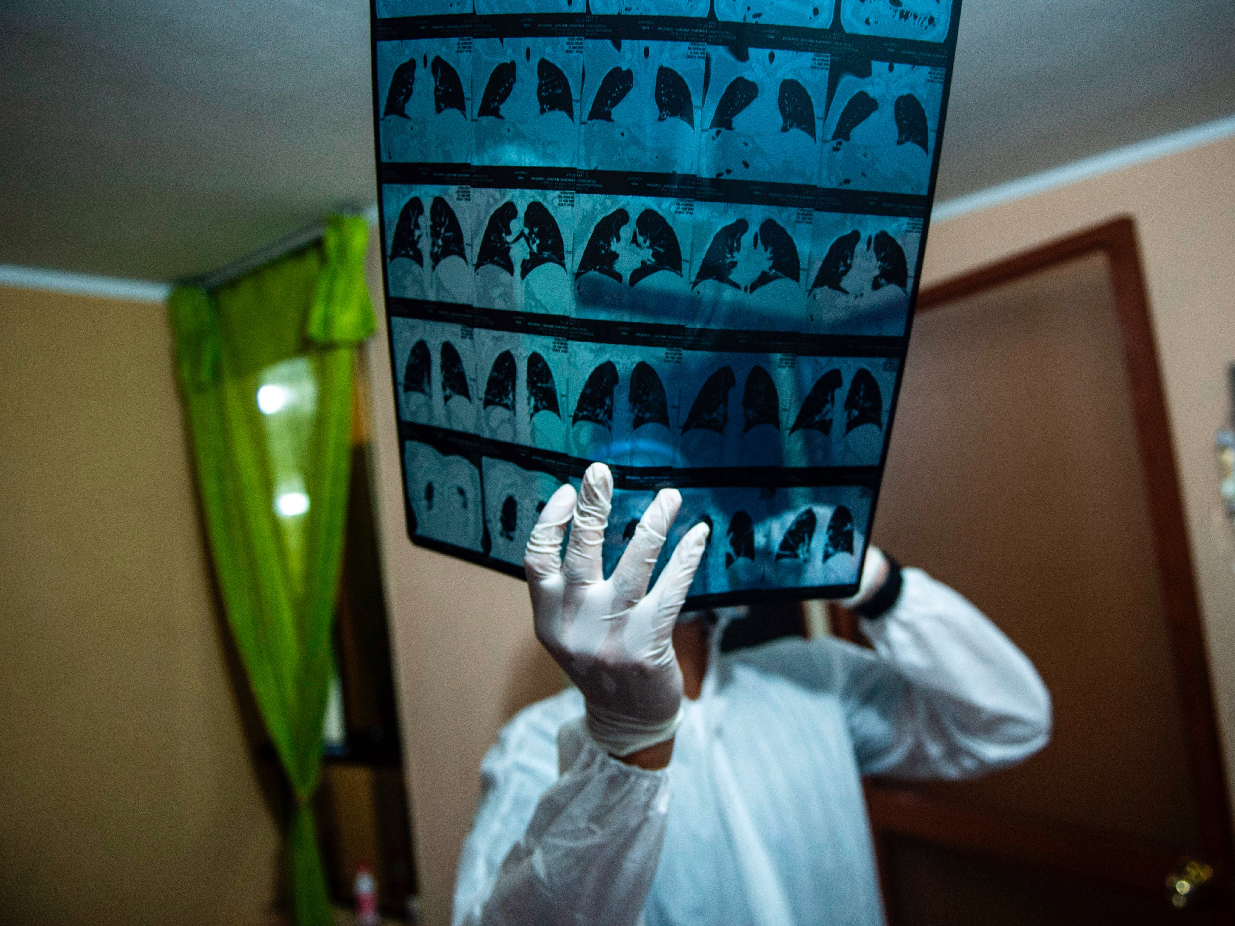 <p>A doctor checks an x-ray of a COVID-19 patient at a home on the eastern outskirts of Lima</p>