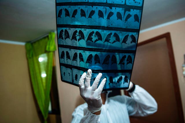 <p>A doctor checks an x-ray of a COVID-19 patient at a home on the eastern outskirts of Lima</p>