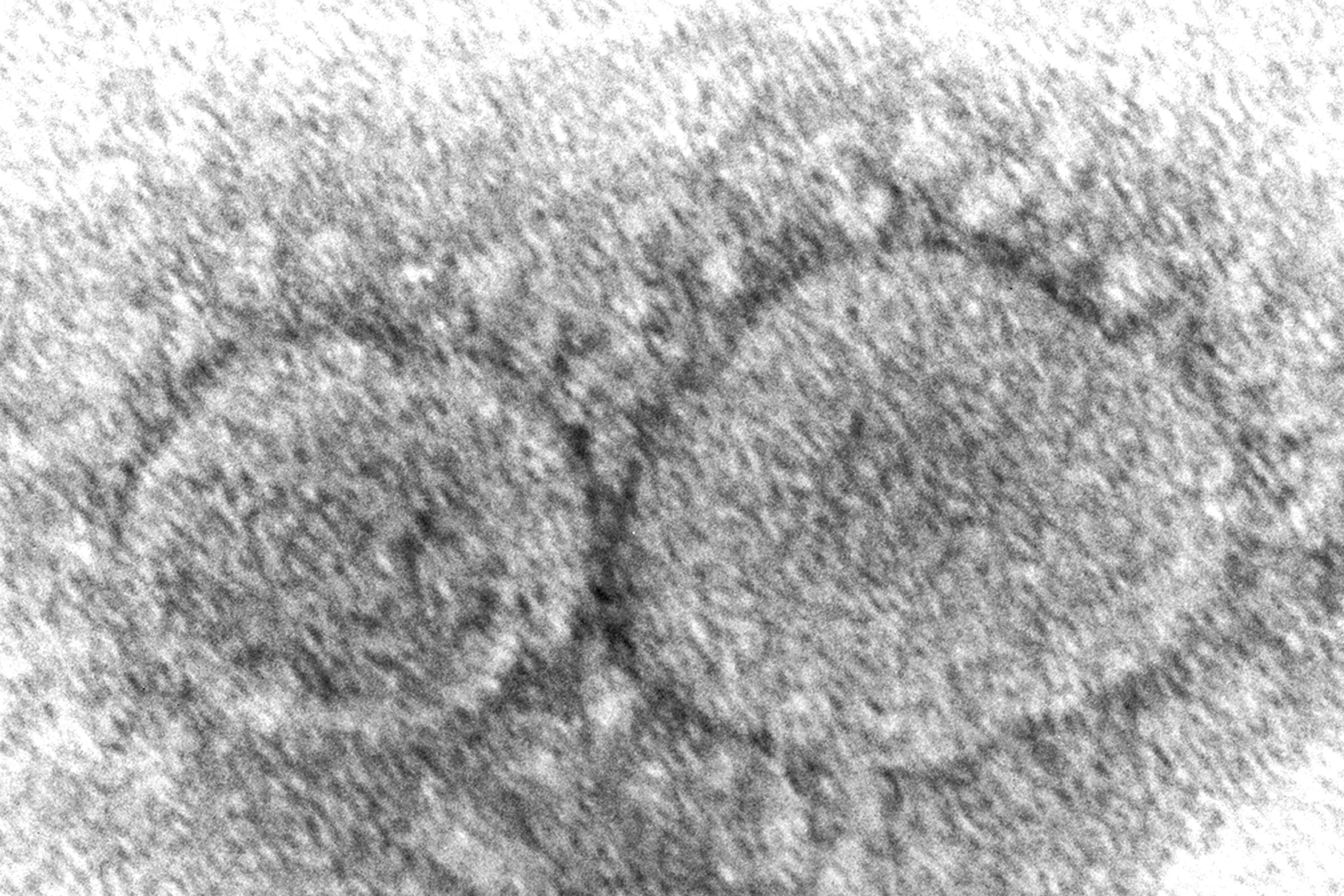 Virus Outbreak Variants Reinfection