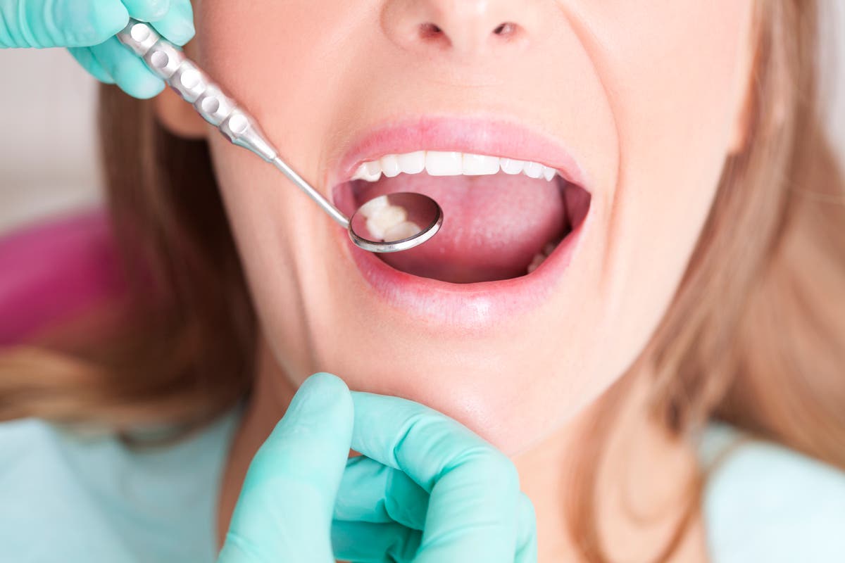 &lsquo;British dentistry, is it?&rsquo;: A trip to an American dentist shattered my confidence