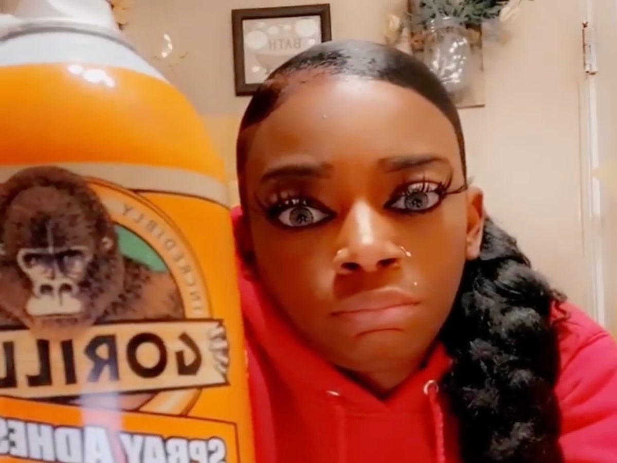 Gorilla Glue Girl' will see a surgeon after putting adhesive spray in hair