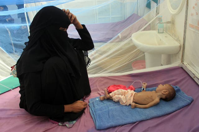  a Yemeni mother sits with her malnourished child during treatment at a medical centre in Yemen's northern Hajjah province