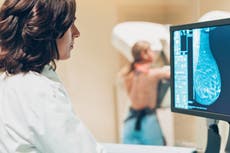 Life-extending drug for incurable breast cancer approved for NHS use