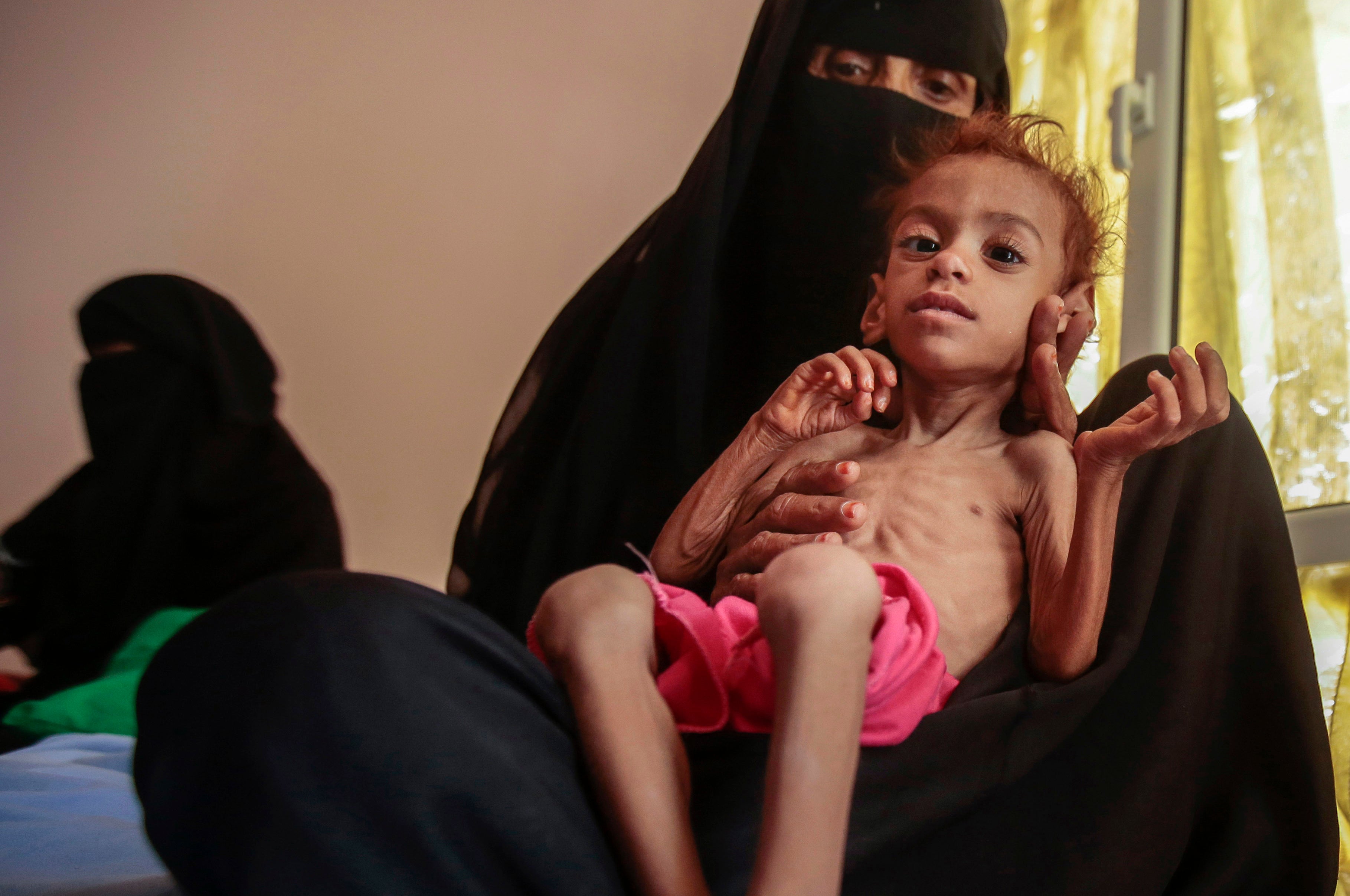 <p>A woman holds a malnourished boy at the Aslam Health Center, in Hajjah, Yemen</p>