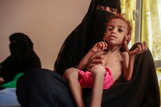 The shame of cutting aid to Yemen will haunt the UK