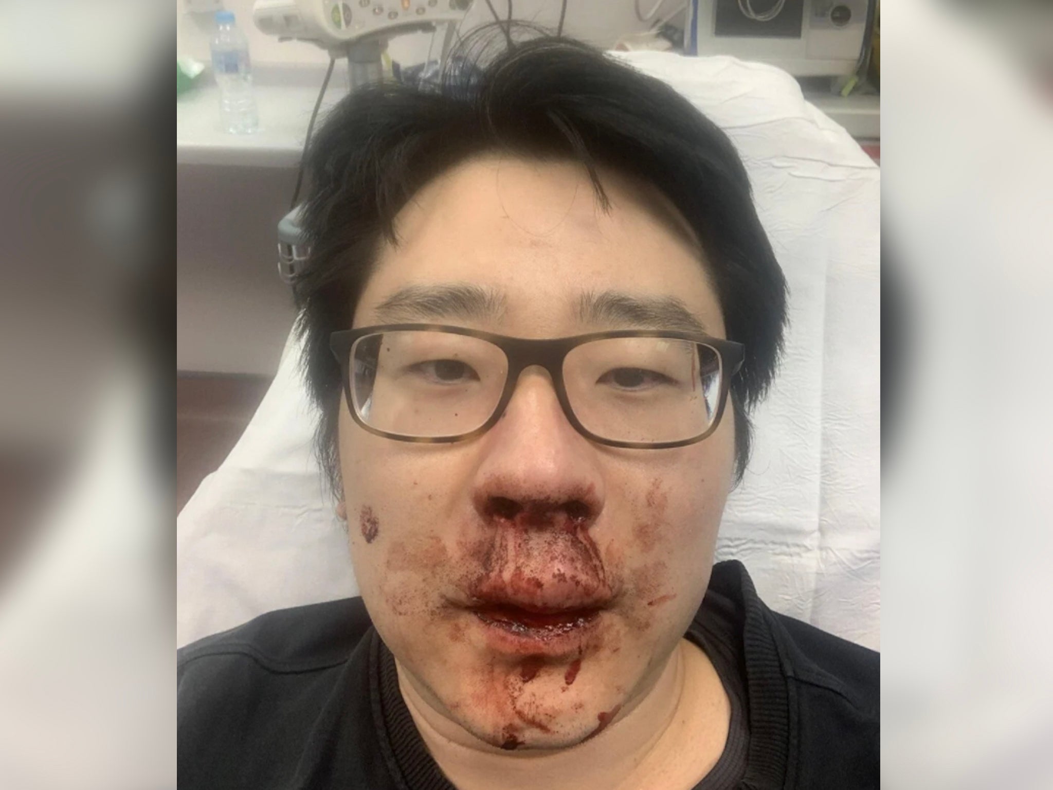 University lecturer Peng Wang, 37, was viciously attacked by four men who shouted racial abuse at him while he was jogging near his home in Southampton