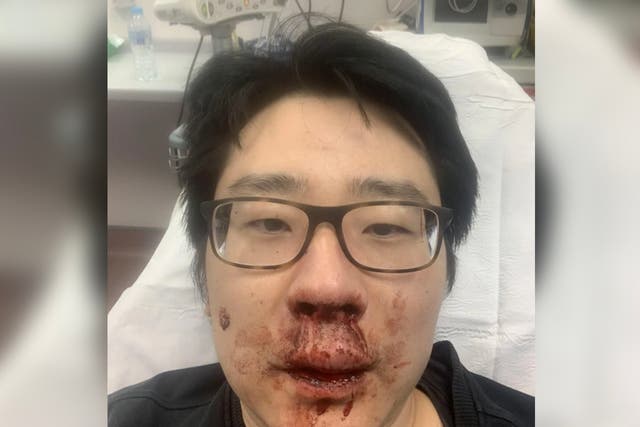 University lecturer Peng Wang, 37, was viciously attacked by four men who shouted racial abuse at him while he was jogging near his home in Southampton