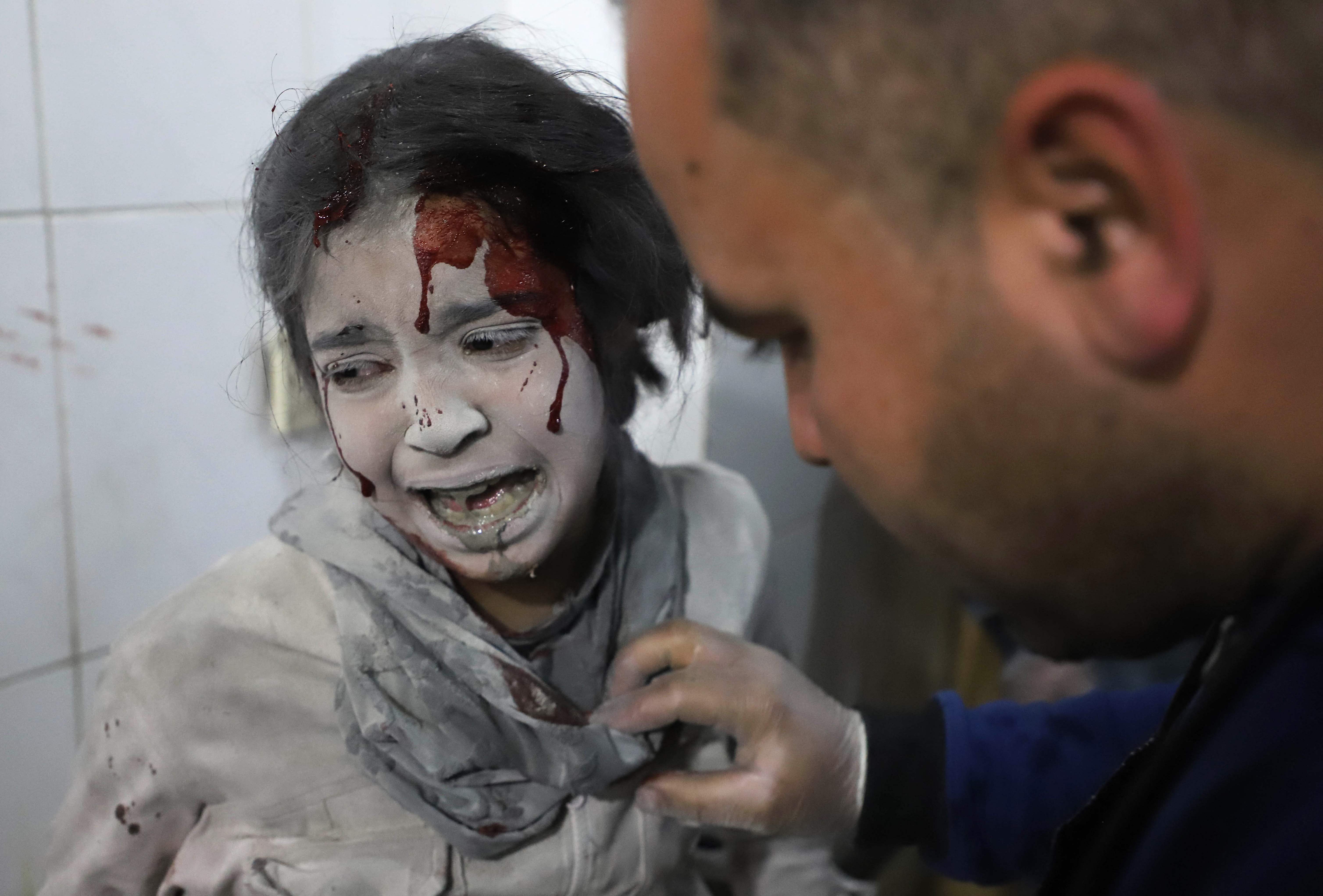 A Syrian girl receives treatment in a makeshift hospital