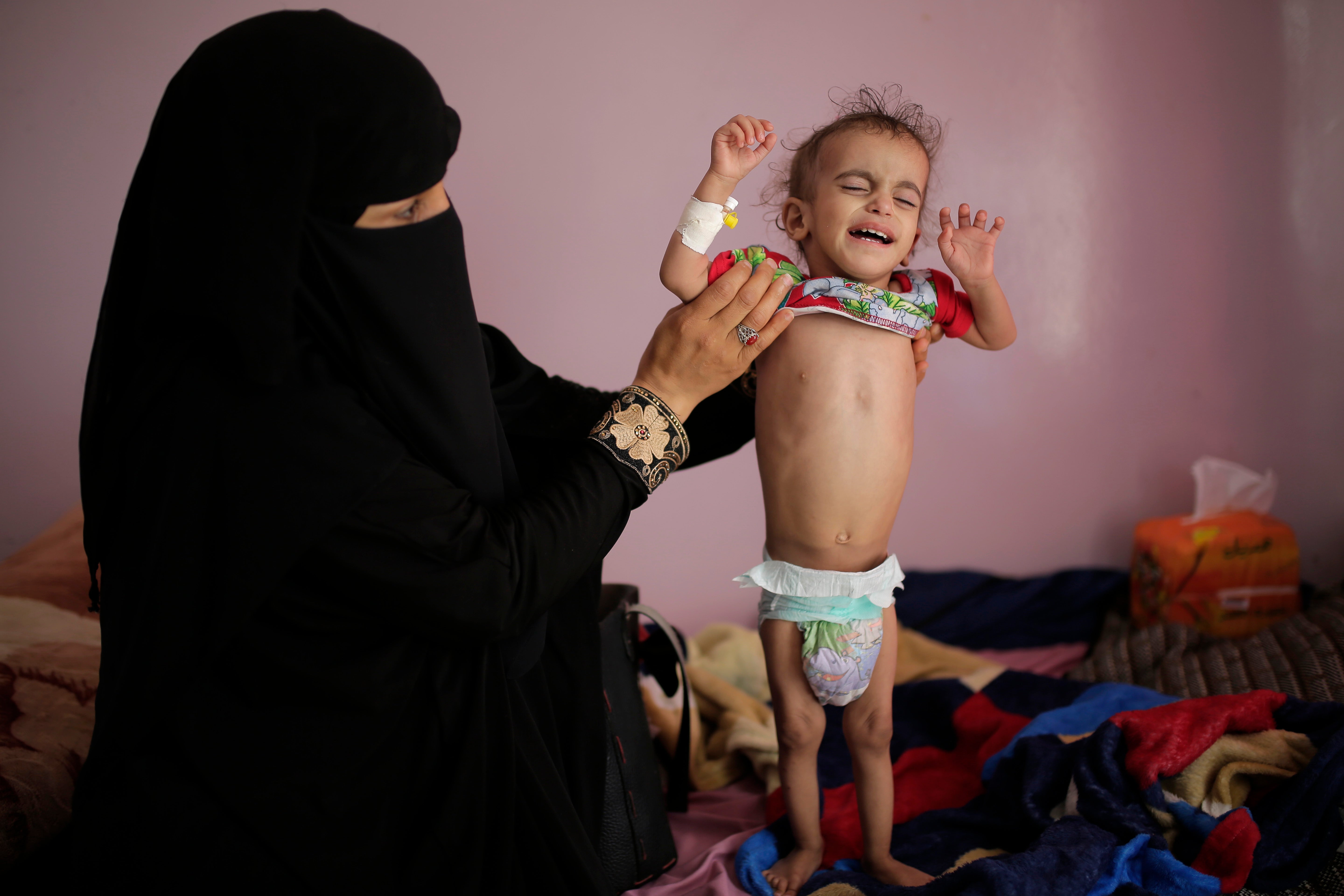 Yemen Famine