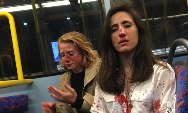 Melania Geymonat and Christine Hannigan after a homophobic attack on a bus in London in 2019