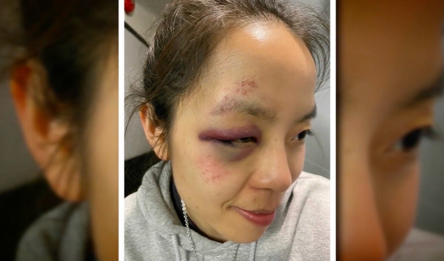 <p>Asian woman dragged by car in San Francisco in latest shocking attack</p>