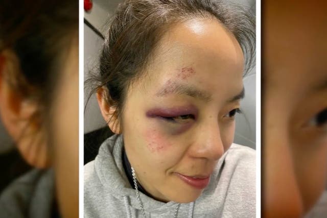 <p>Asian woman dragged by car in San Francisco in latest shocking attack</p>