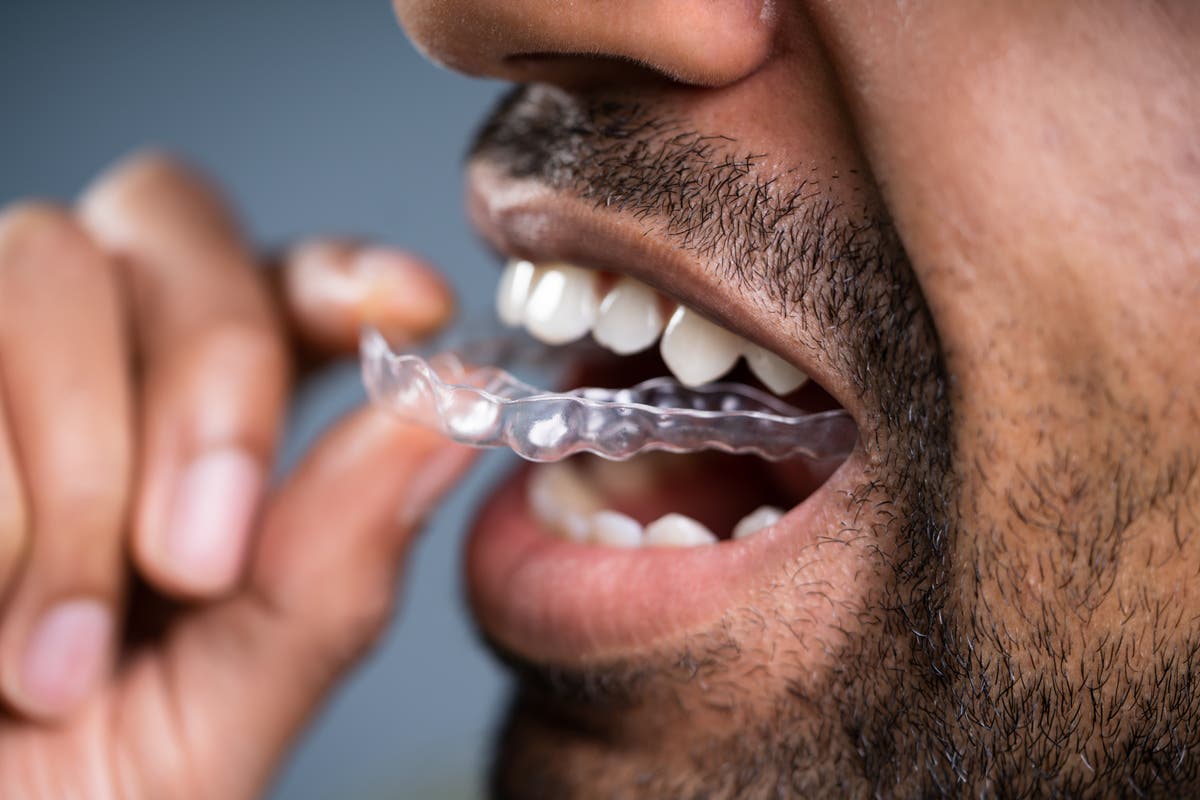 Dentists report increase in teeth grinding and clenching as a result of stress amid pandemic