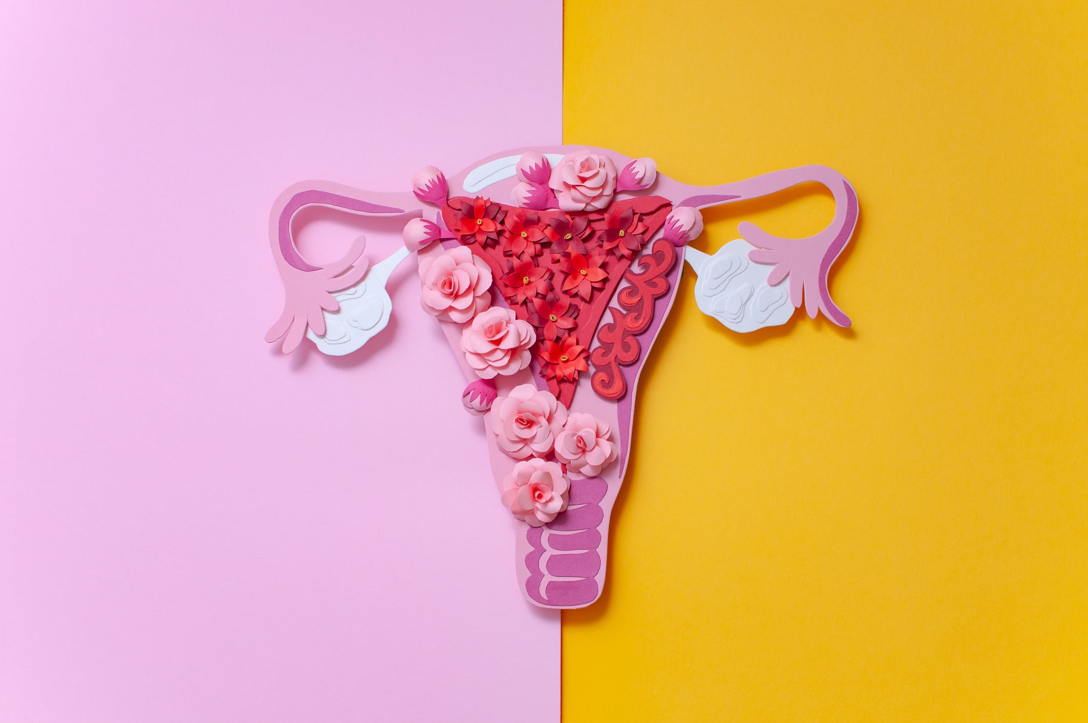 Endometriosis was identified in the 1920s but its causes are still not understood