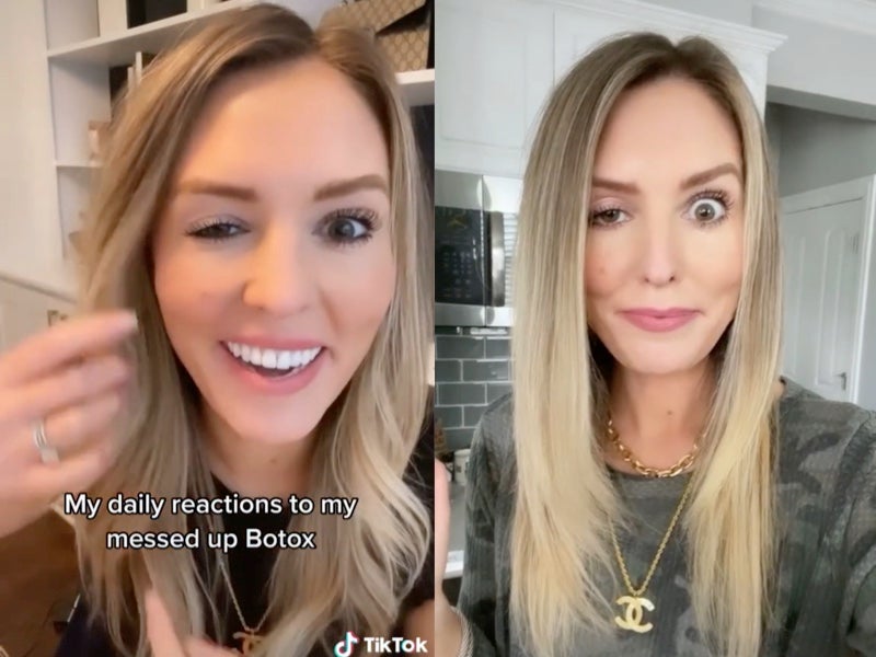 Influencer praised for being transparent about Botox incident