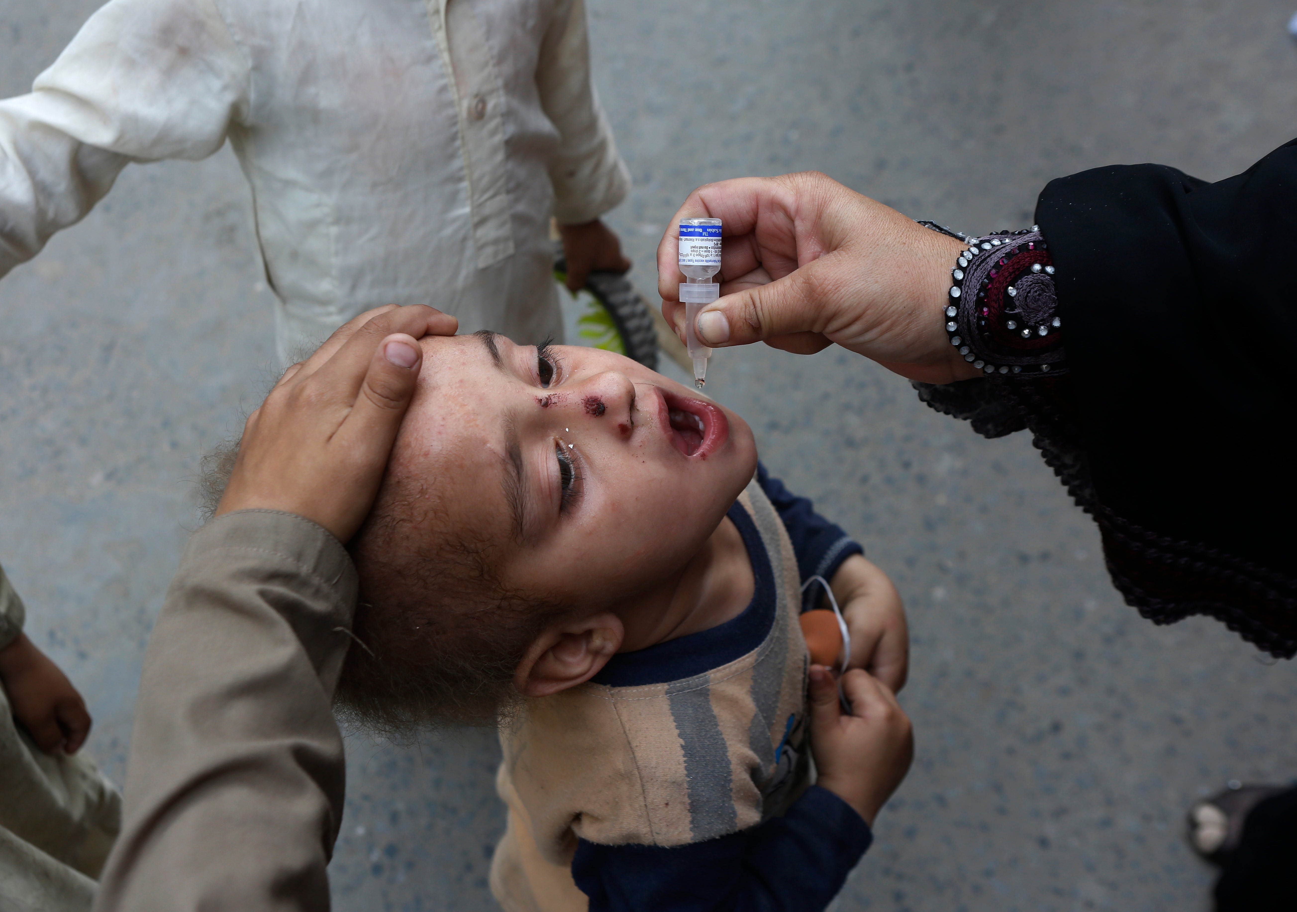 APTOPIX Pakistan Polio