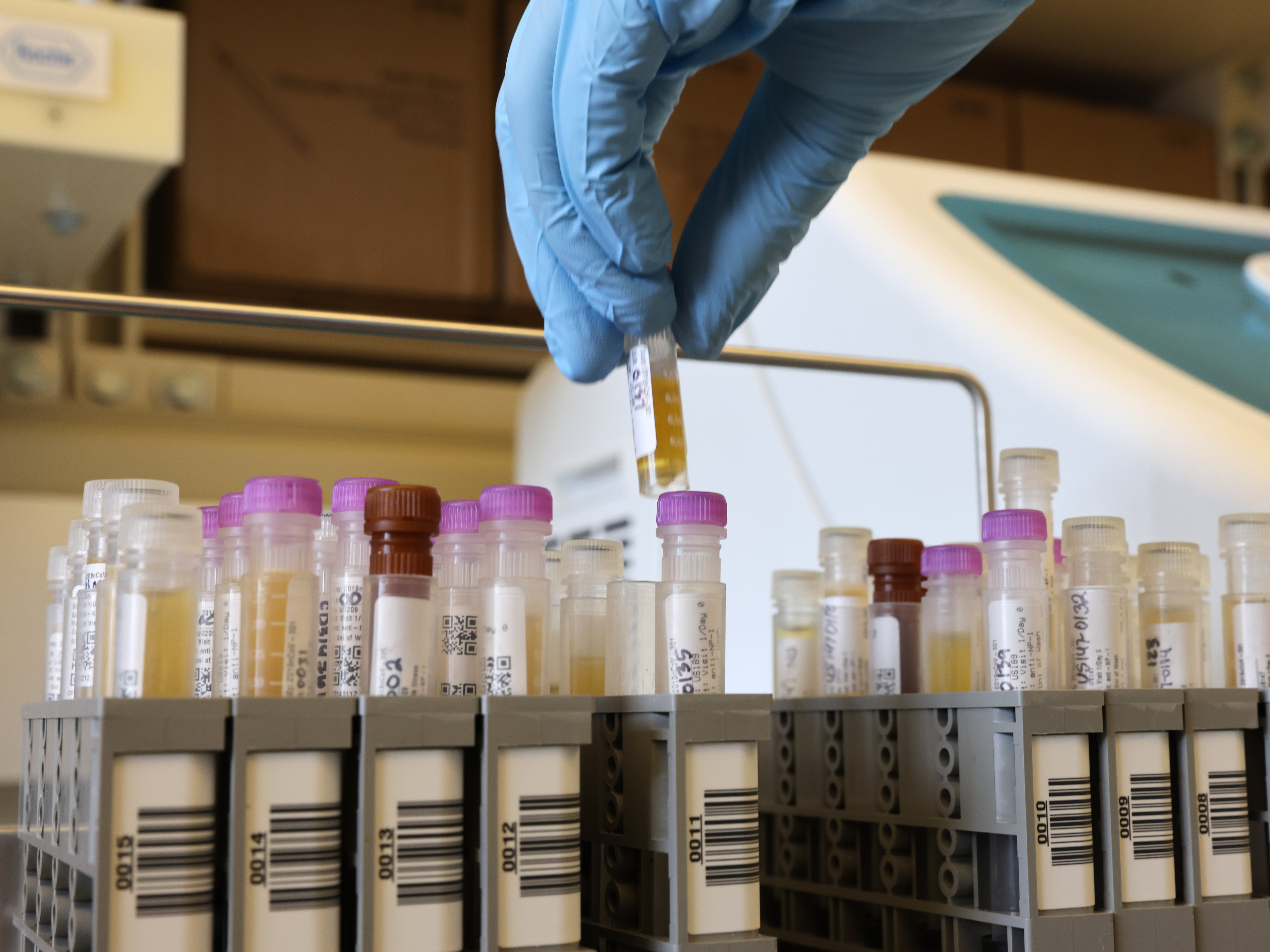 <p>Los investigadores trabajan con muestras de un ensayo de fase 3 de Novavax en Seattle, Washington.</p>