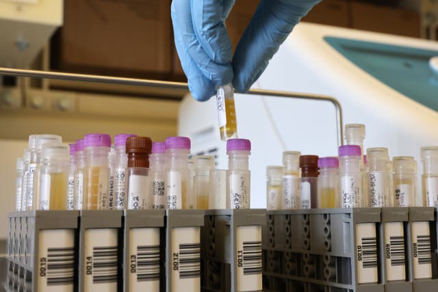 Researchers work on samples from a Novavax phase 3 trial in Seattle, Washington