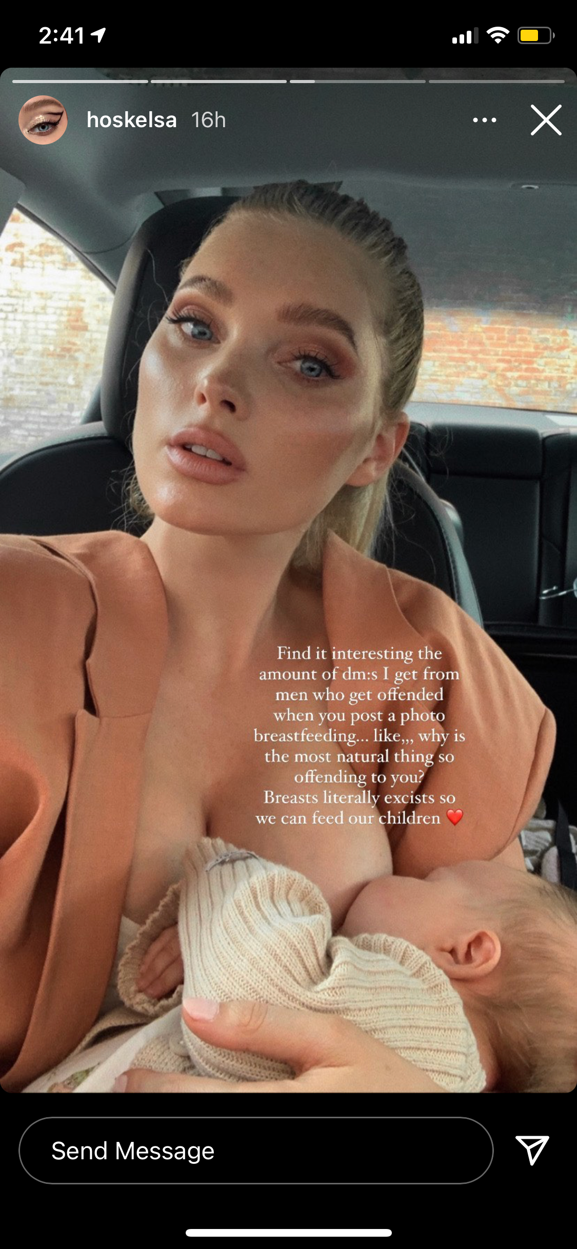 Elsa Hosk says she received DMs from men offended by her breastfeeding photos