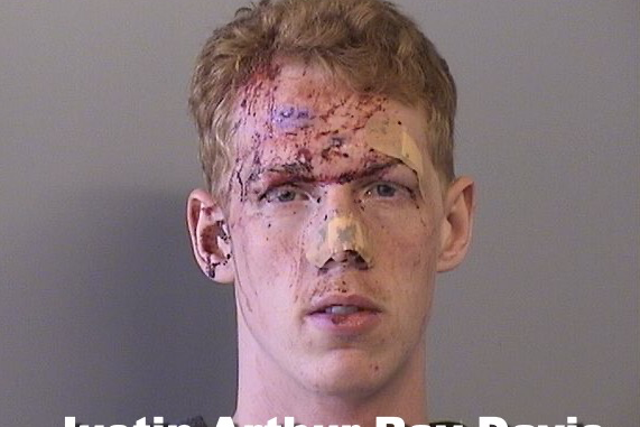 <p>Bloody mugshot of alleged stalker Justin Arthur-Ray Davis who tried to kidnap ex-colleague</p>