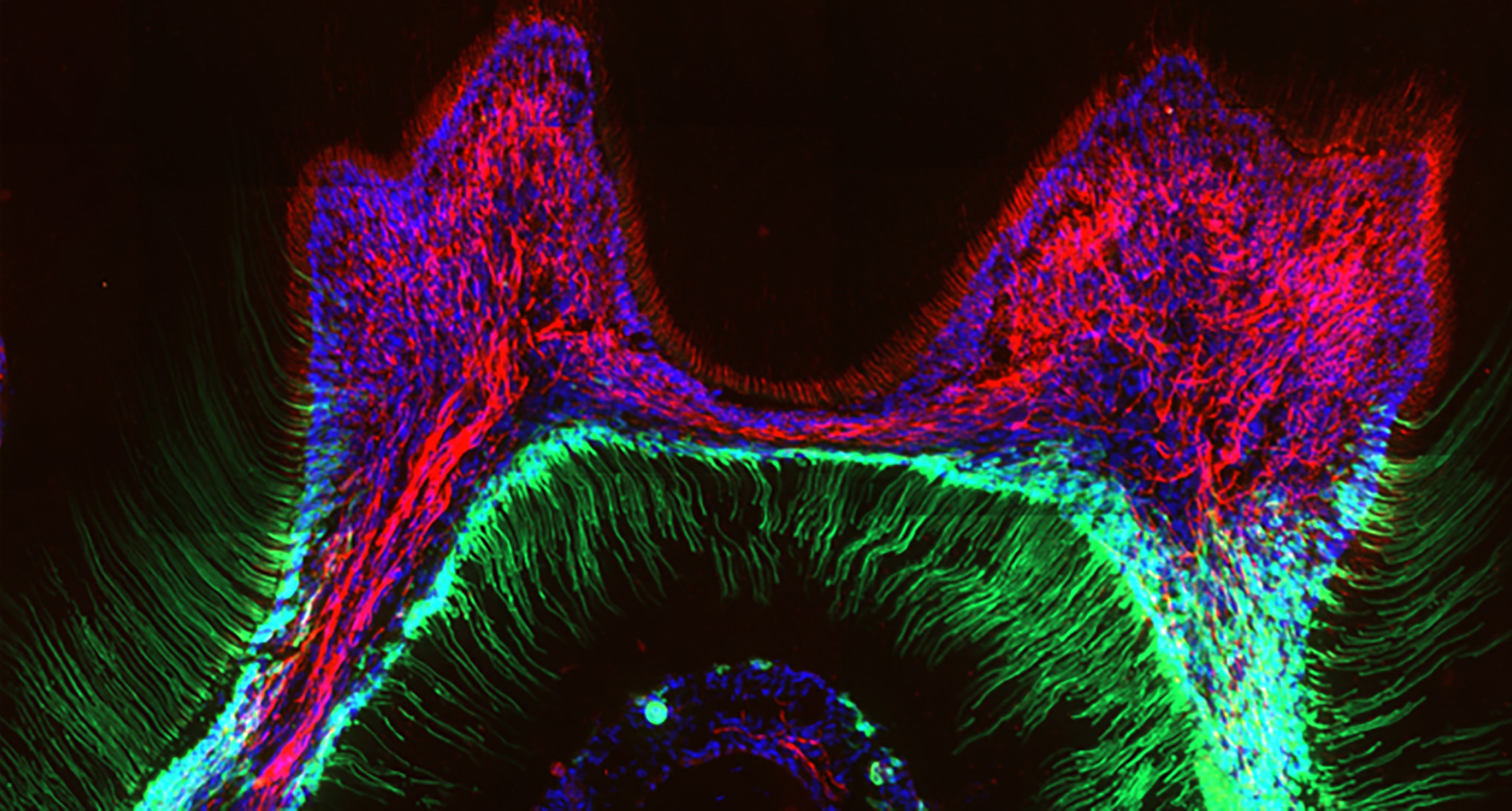 Good news for people who have to suffer for their ice cream