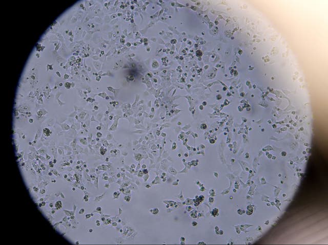 Cells containing Sars-CoV-2 are seen through a microscope at the Stabilitech laboratory in Burgess Hill, south-east England