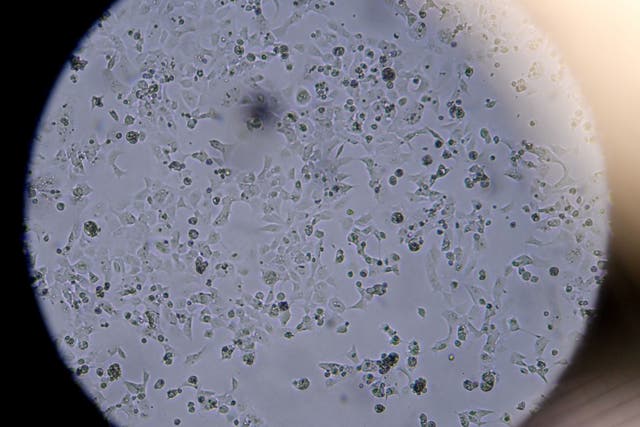 Las células que contienen Sars-CoV-2 se ven a través de un microscopio en el laboratorio Stabilitech en Burgess Hill, sureste de Inglaterra