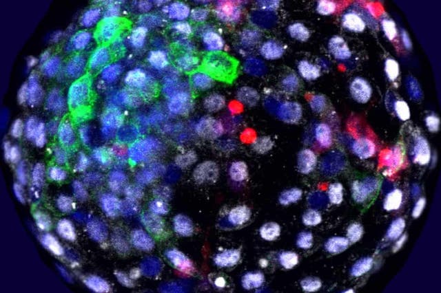 An image from the Salk Institute shows human cells grown in an early stage monkey embryo
