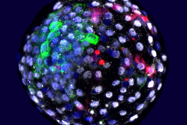 Photo scientists say shows human cells grown in an early stage monkey embryo