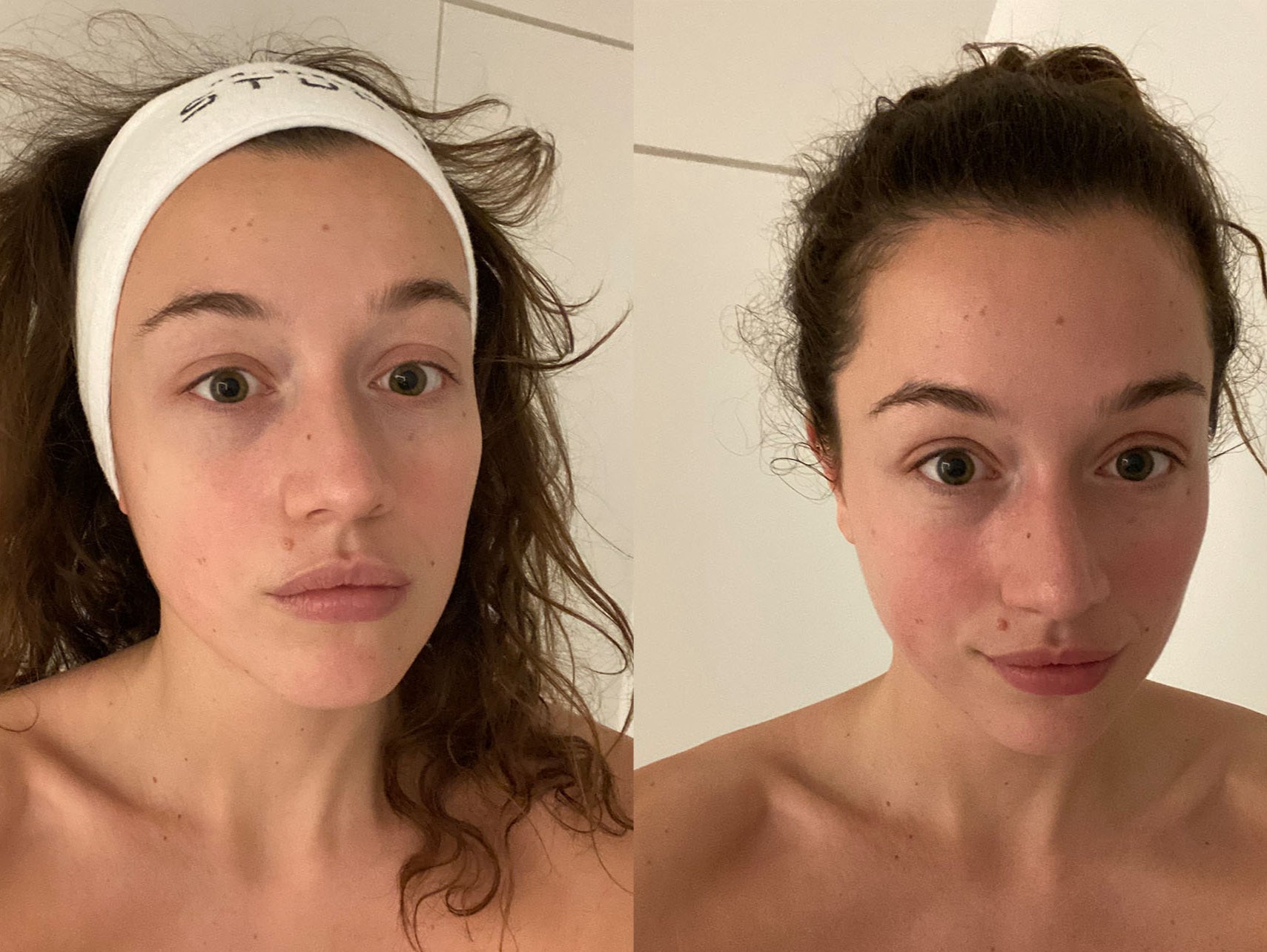 Before (left) and after (right) the treatment