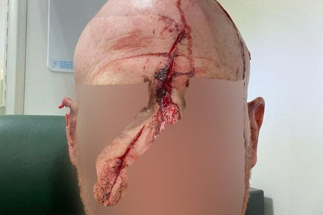 The volunteer’s head was streaked with blood. His face was hidden by hunt sabs to protect his identity