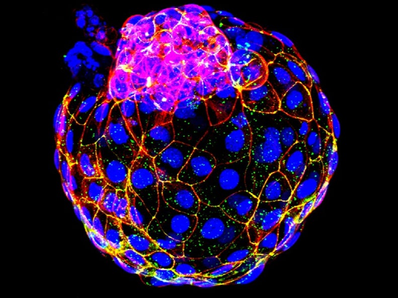 An artificial blastocyst – the very early formation of an embryo – made from human stem cells