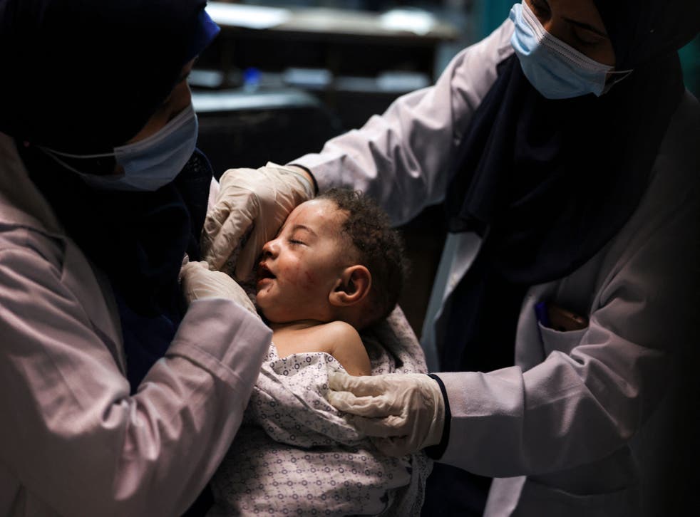 A nurse tends to five month old Omar al-Hadidi