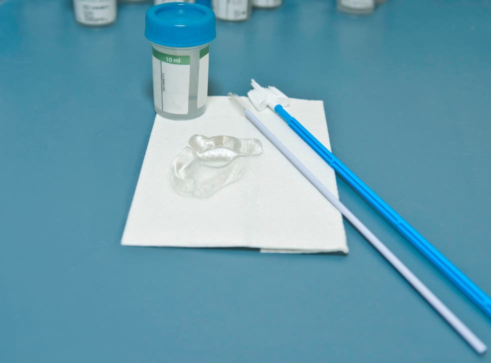 Pap smear medical test
